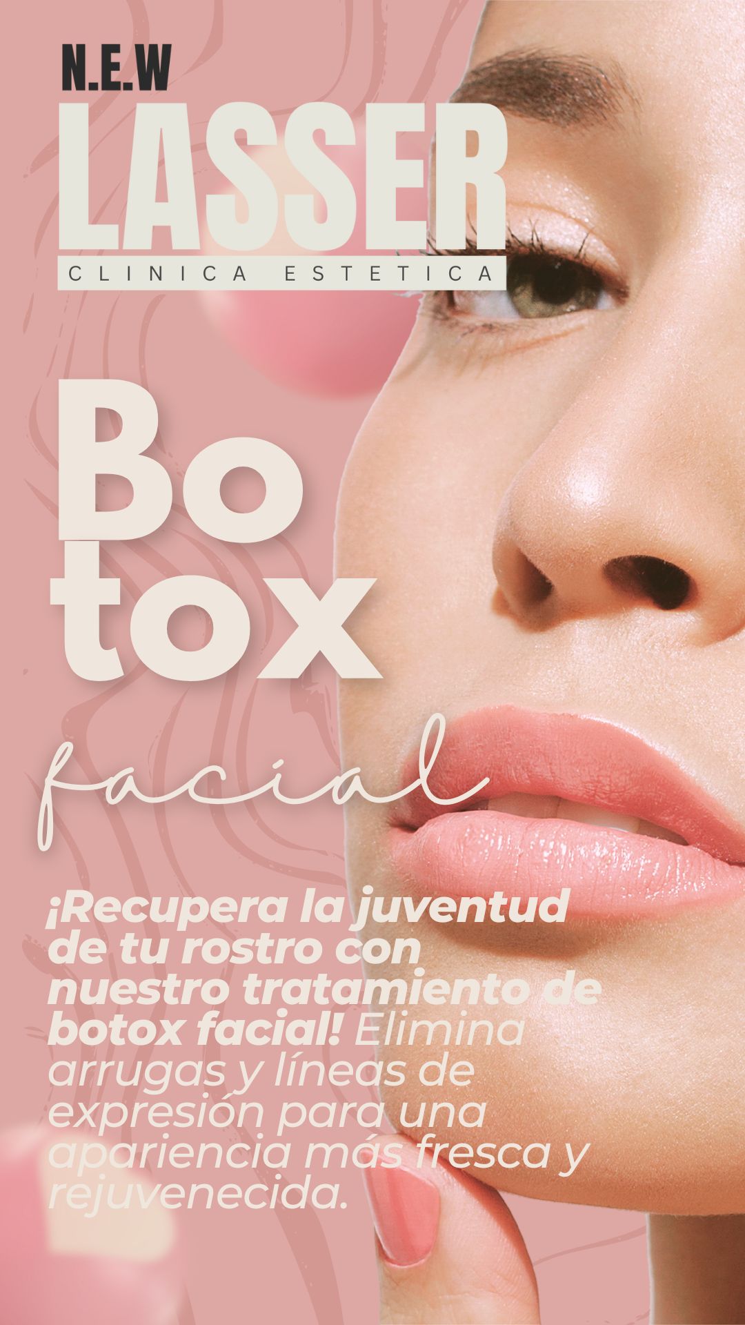 Tratamiento con Botox