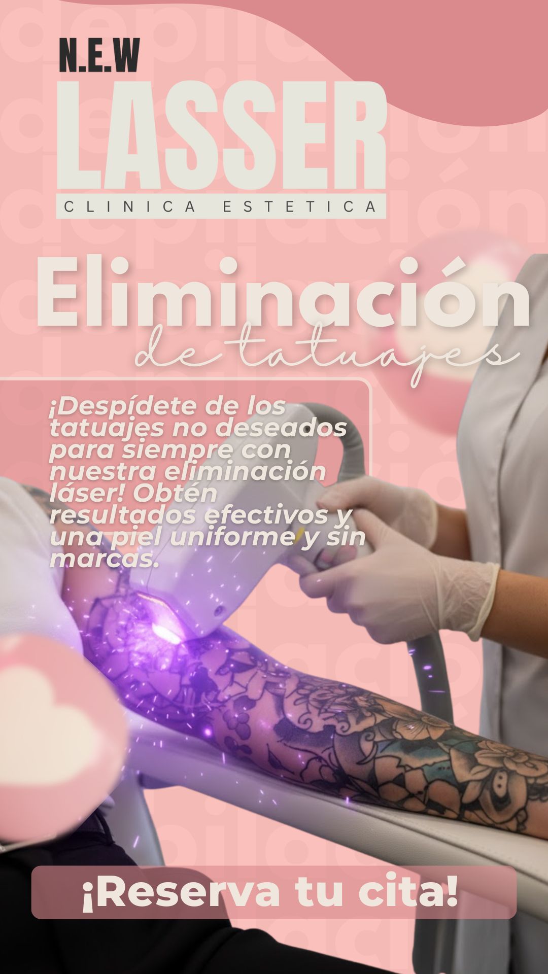 Eliminación de Tatuajes